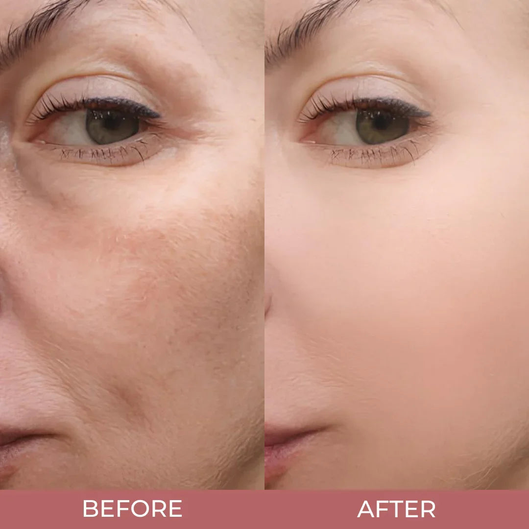 Visibly Smaller Pores in 1 Week | Peel Shot Glow Rice Ampoule Duo